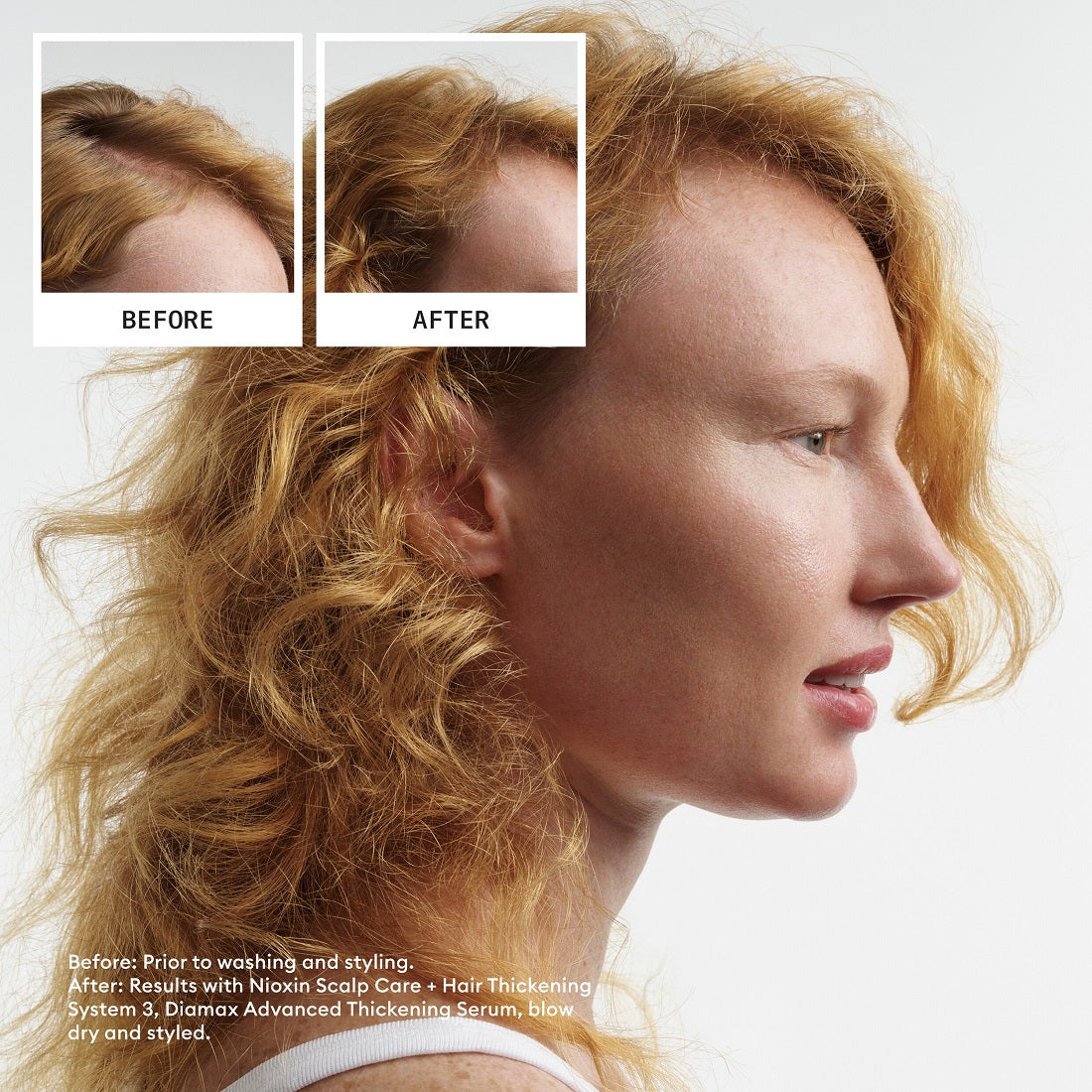 NIOXIN SYSTEM 3 - Kit - Treatment for Colored Hair with Mild Thinning 3 units