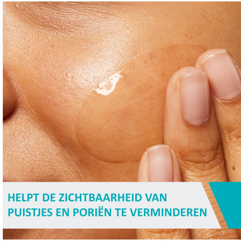 CERAVE BLEMISH control gel 40 ml