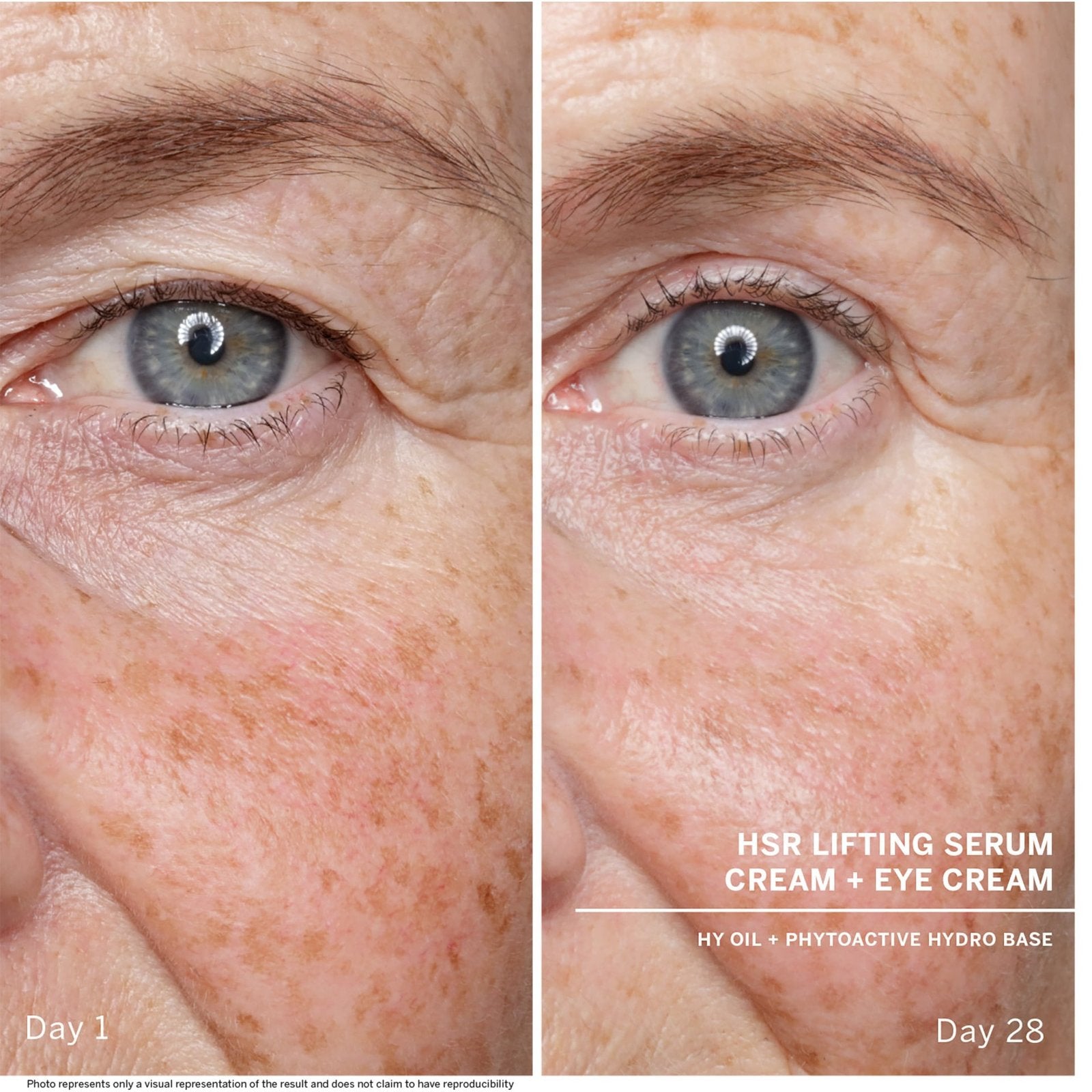 BABOR HSR LIFTING anti-wrinkle serum 30 ml