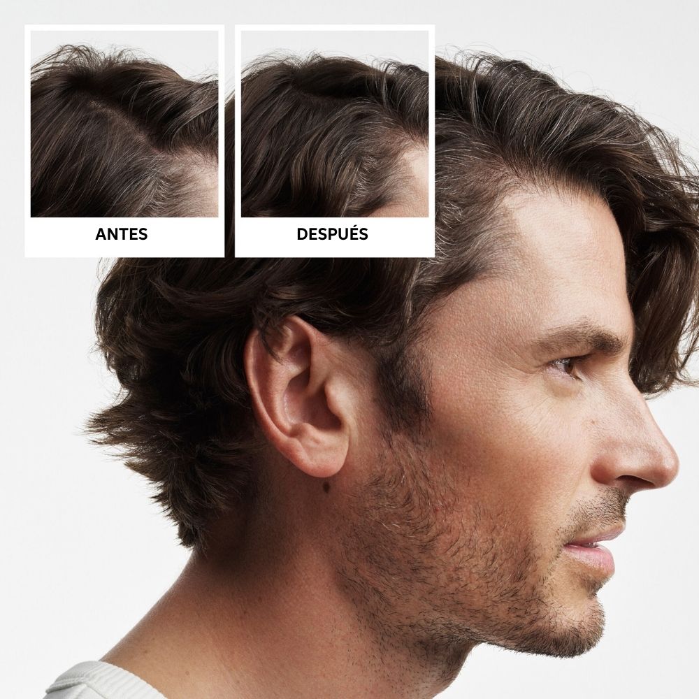 NIOXIN SYSTEM 2 - Kit - Treatment for Natural Hair with Advanced Thinning 3 units