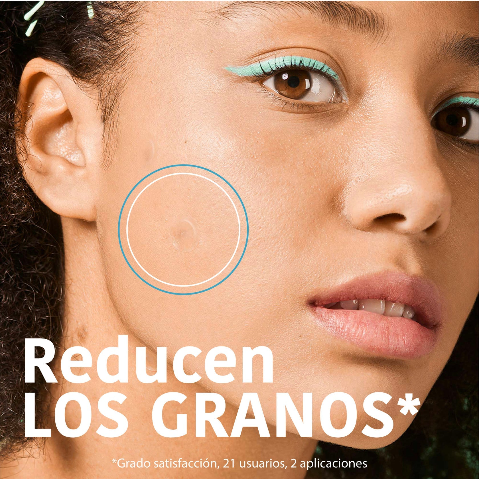 IROHA SOS pimple patches 18 u