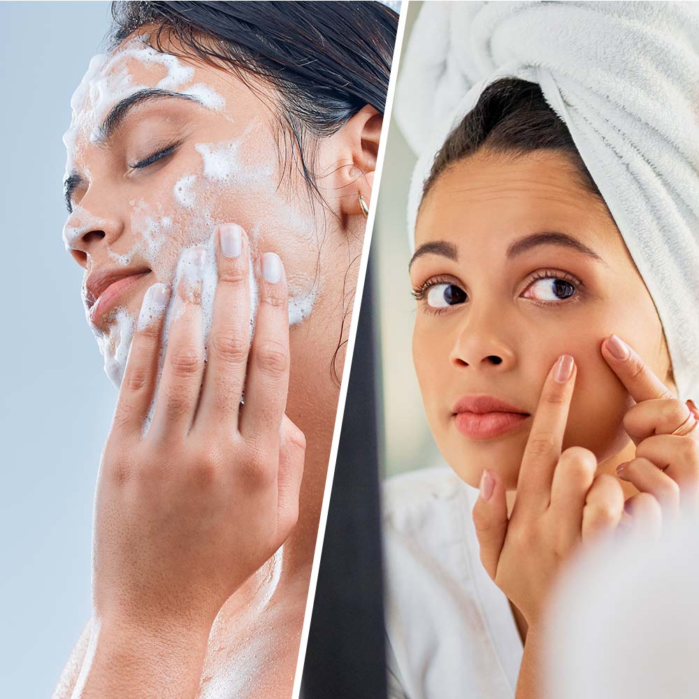 BIOVÈNE SALICYCLIC SUPER CLEANSER face &amp; body blackhead + breakout 200 ml