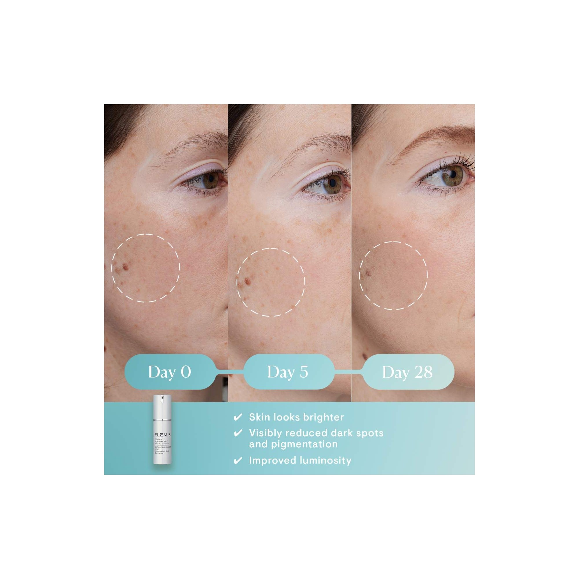 ELEMIS DYNAMIC RESURFACING super-c serum 30 ml