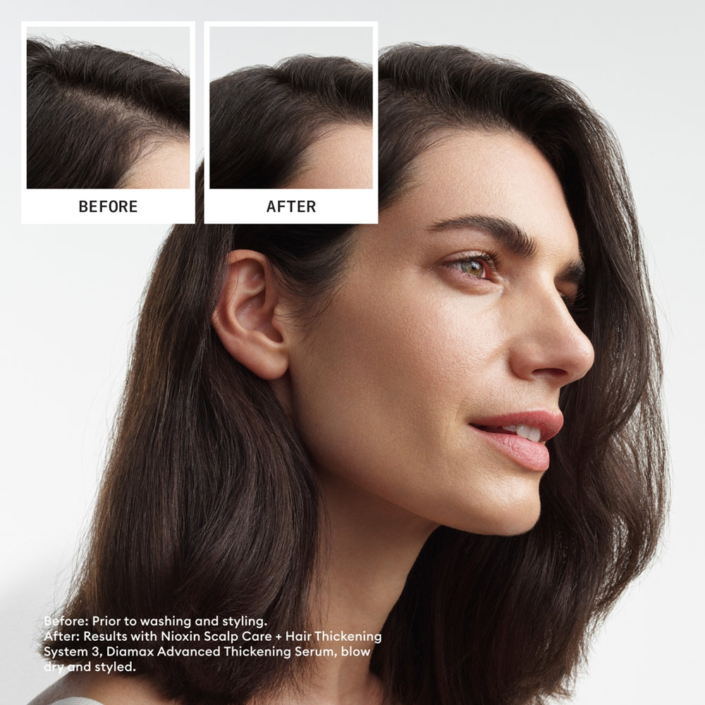 NIOXIN SYSTEM 3 - Kit - Treatment for Colored Hair with Mild Thinning 3 units