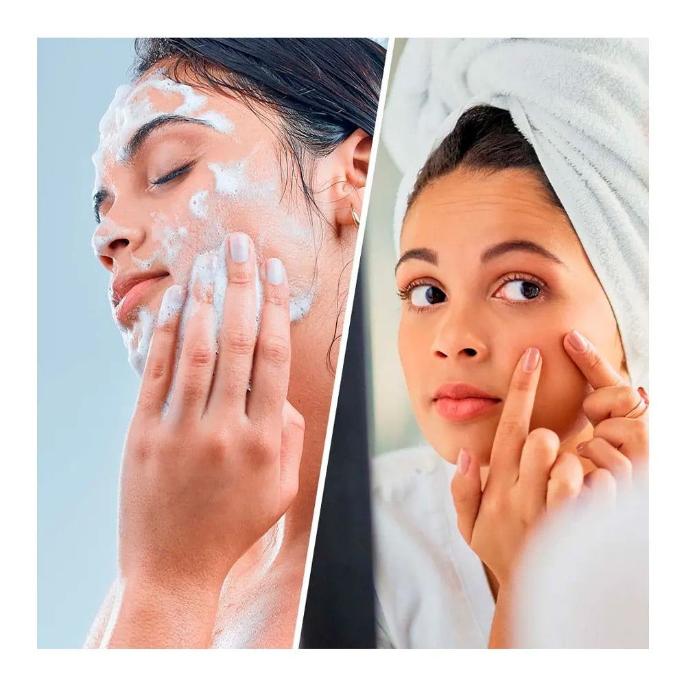 BIOVÈNE SALICYCLIC SUPER CLEANSER face &amp; body blackhead + breakout 200 ml
